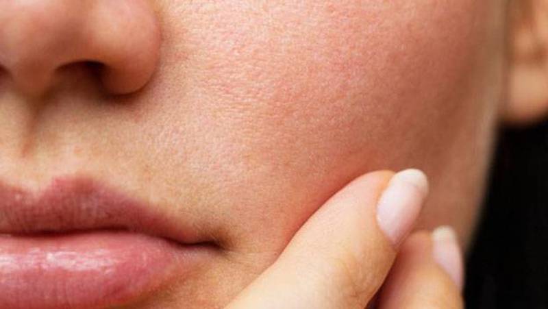 Te enseñamos cuatro recetas casera para eliminar los poros abiertos de tu  piel