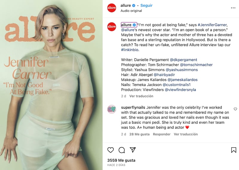 La actriz de ‘Si Yo Tuviera 30’ apareció en la portada de Allure mostrando su lado más sensual.