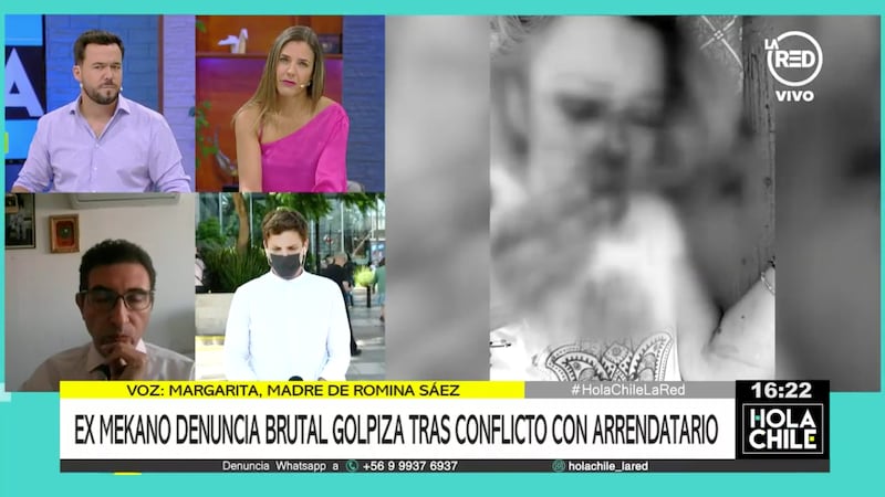 Romina Sáez sufrió brutal agresión