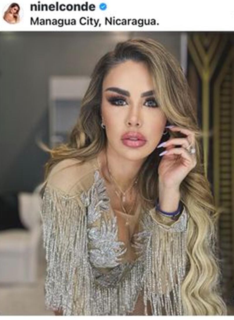 Ninel Conde rostro