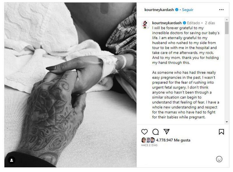 El bebé de Kourtney Kardashian y Travis Barker tuvo que ser sometido a una cirugía fetal