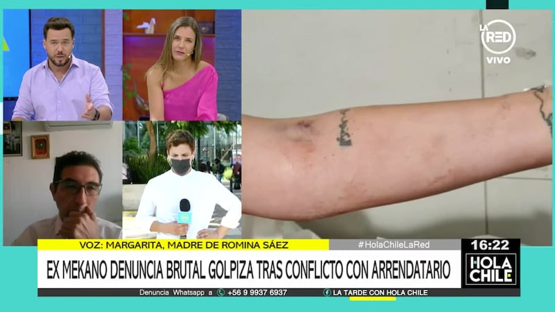 Romina Sáez sufrió brutal agresión