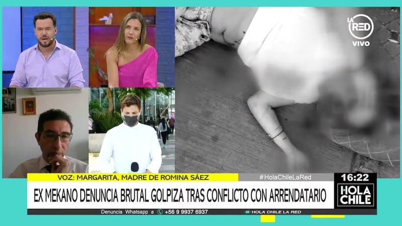 Romina Sáez sufrió brutal agresión