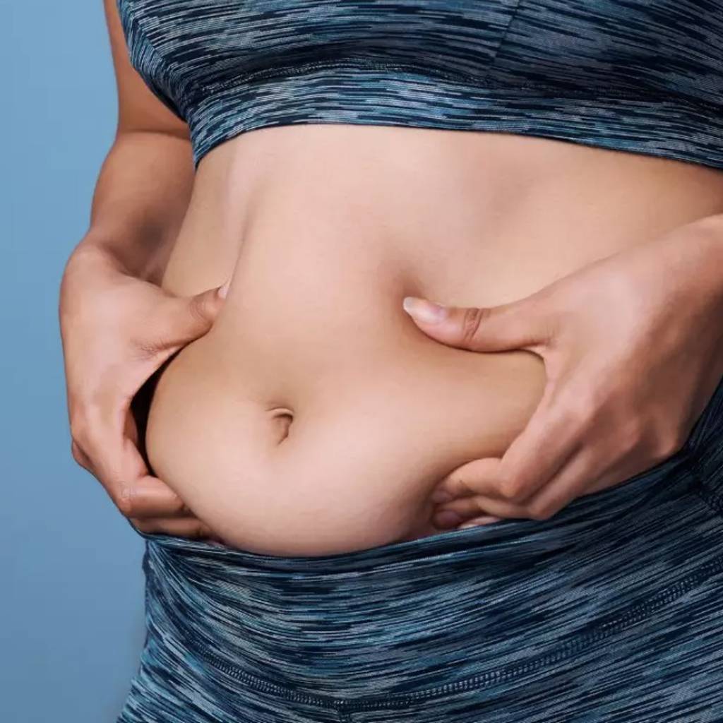 Qué causa la grasa debajo del ombligo, vientre bajo